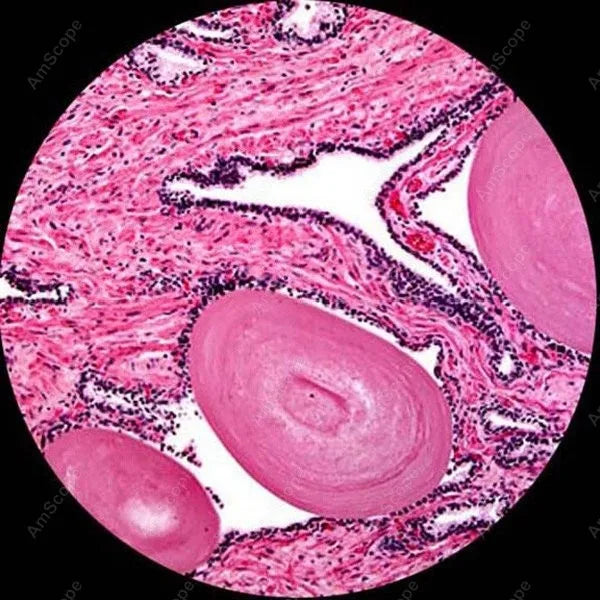 AmScope 40X-2500X Trinocular Biological Compound Microscope
