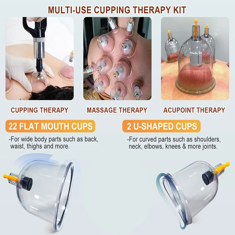 12-Piece Vacuum Cupping Therapy Set with Storage Bag
