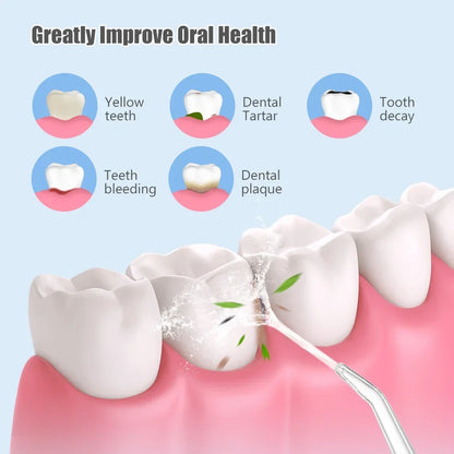 Portable Water Flosser Teeth Cleaner with 4 Tips