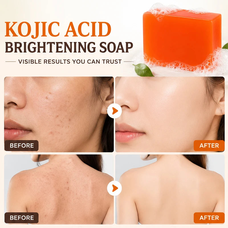 Amococo Kojic Acid Facial & Body Soap Bar (6-Pack Set)