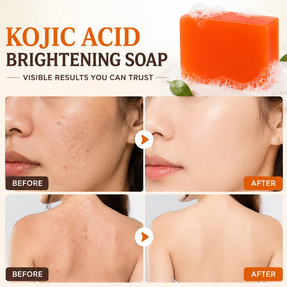 Amococo Kojic Acid Facial & Body Soap Bar (6-Pack Set)